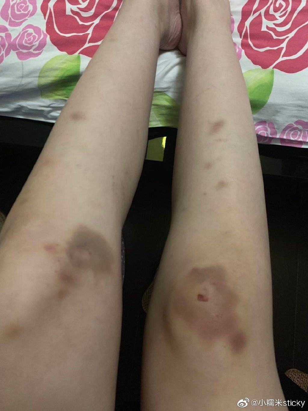 TI10亞軍LGD戰隊教練小八被前妻實錘 博彩打假賽