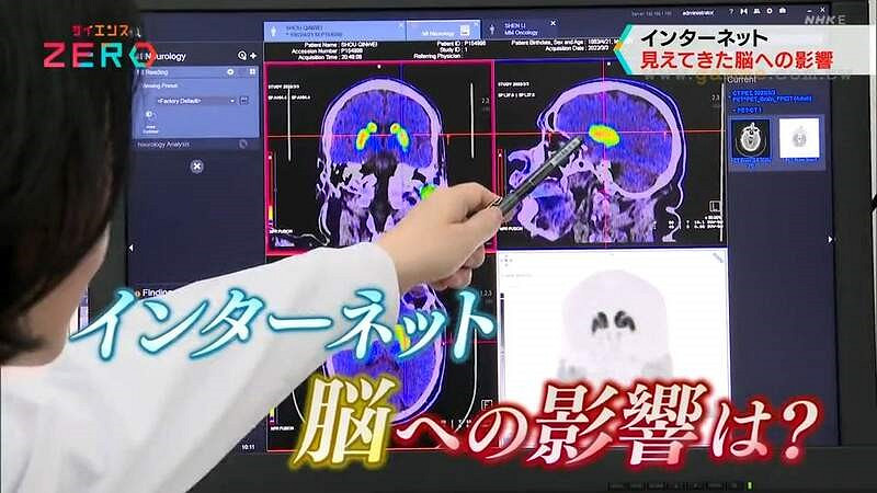 日媒報導「電玩成癮」患者被噴!網友:他被遊戲救贖! 日媒報導「電玩成癮」患者被噴!網友:他被遊戲救贖!