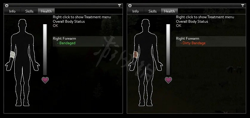 《殭屍毀滅工程》怎麽處理傷口?傷口處理方法介紹 《殭屍毀滅工程》怎麽處理傷口?傷口處理方法介紹