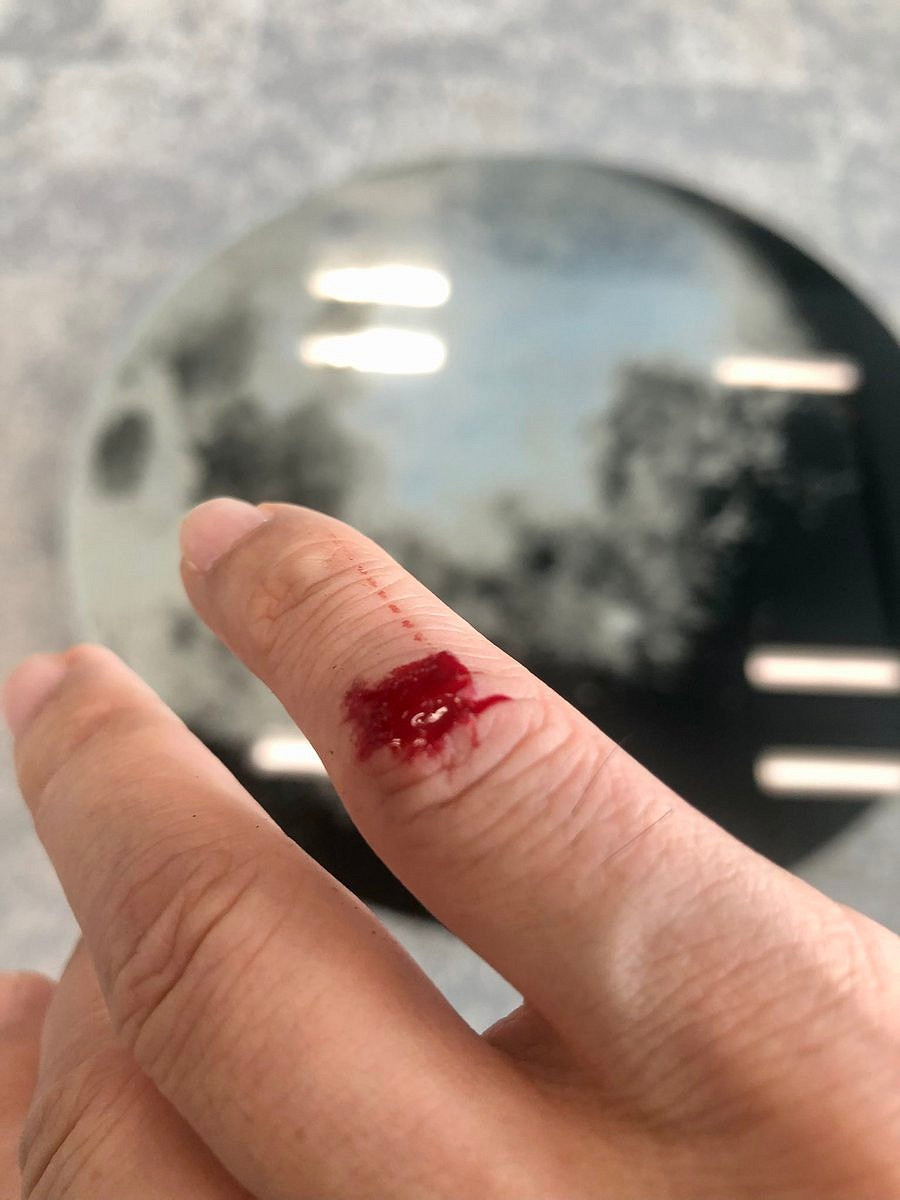 淋了時間雨！小島秀夫不幸摔倒：曬出傷勢，島哥小心！