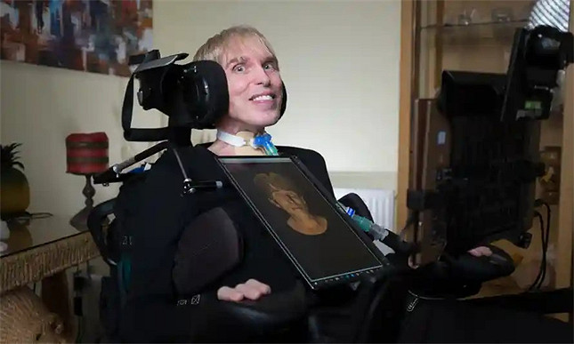 真的不是科幻小說!全球首位賽博人的傳奇一生 真的不是科幻小說!全球首位賽博人的傳奇一生