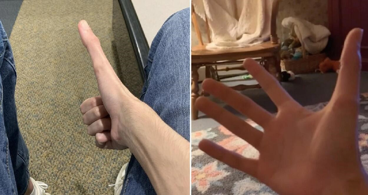 美國小哥大拇指竟有13cm！打《虹彩六號》世界前十